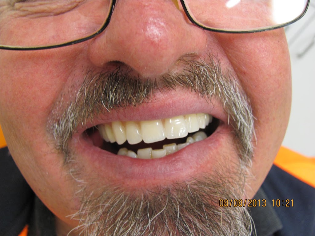 Reservoir Denture Clininc | health | 233 Broadway, Reservoir VIC 3073, Australia | 0394623000 OR +61 3 9462 3000