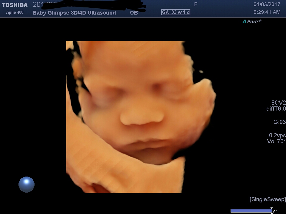 Baby Glimpse 3D/4D ultrasound | 2 Boronia Ave, Burwood NSW 2134, Australia | Phone: 0405 068 603