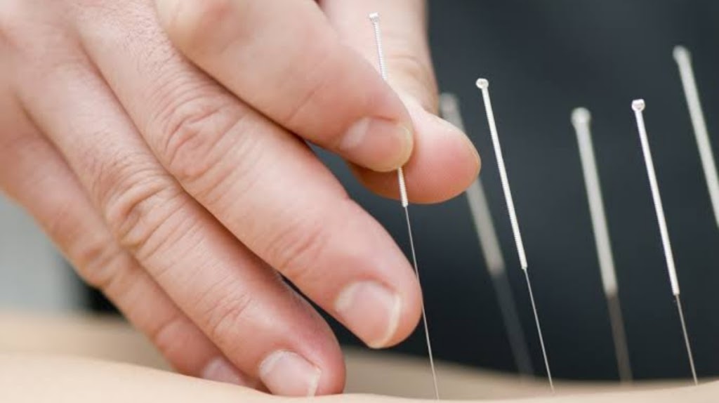 Ferntree Gully Acupuncture | Level 1/823 Burwood Hwy, Ferntree Gully VIC 3156, Australia | Phone: (03) 8719 7373