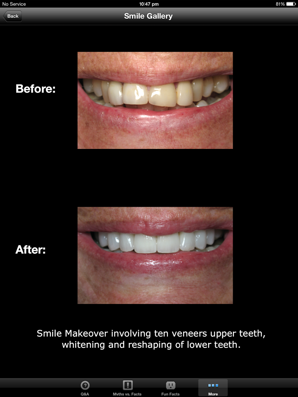 Revesby Dental Surgery | dentist | 11 Selems Parade, Revesby NSW 2212, Australia | 0297926633 OR +61 2 9792 6633
