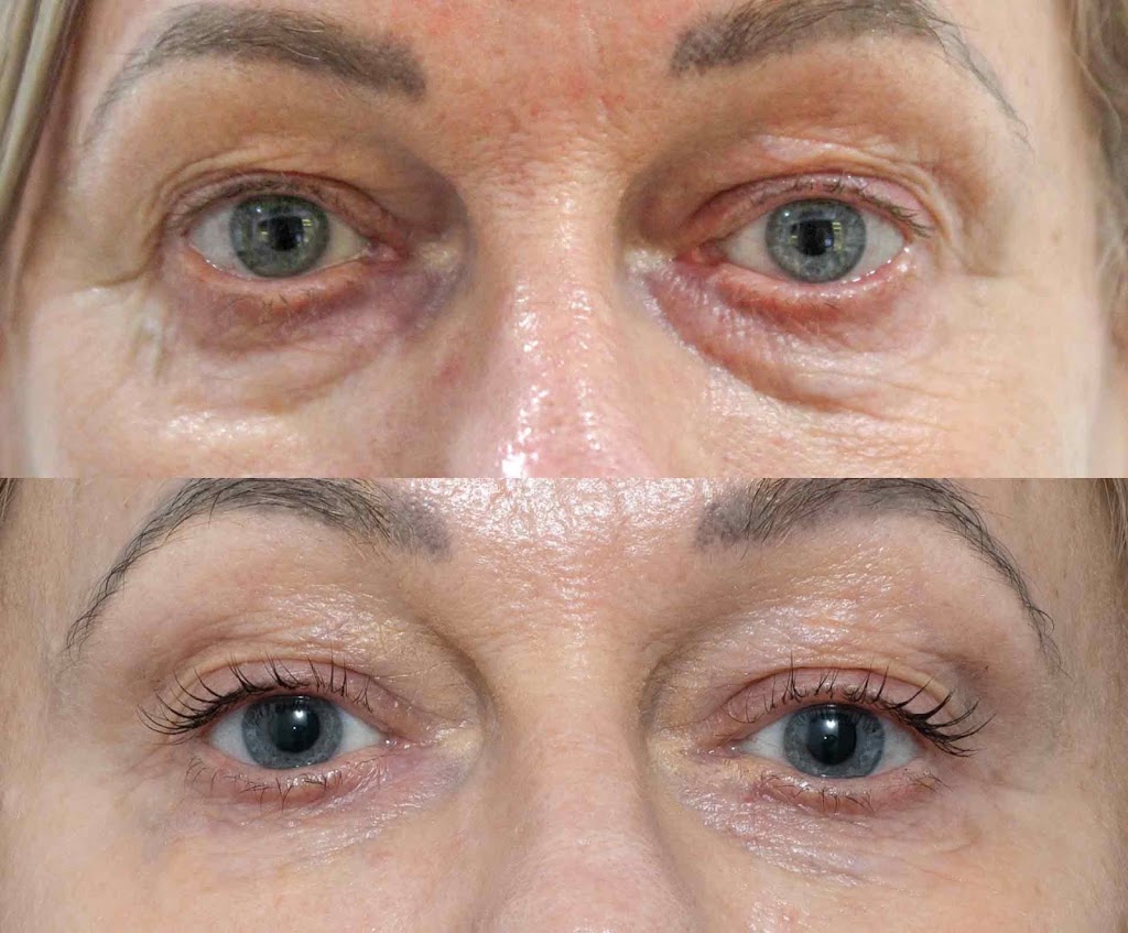 Oh My Skin Maitland | 43 Louth Park Rd, South Maitland NSW 2320, Australia | Phone: 0485 997 894