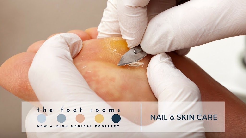 The Foot Rooms Albion Park Podiatry | doctor | Shop 1, 171 tongarra road, Cnr of Tongarra road & Russell Street, Albion, Park, NSW 2527, Albion Park NSW 2527, Australia | 0242631268 OR +61 2 4263 1268