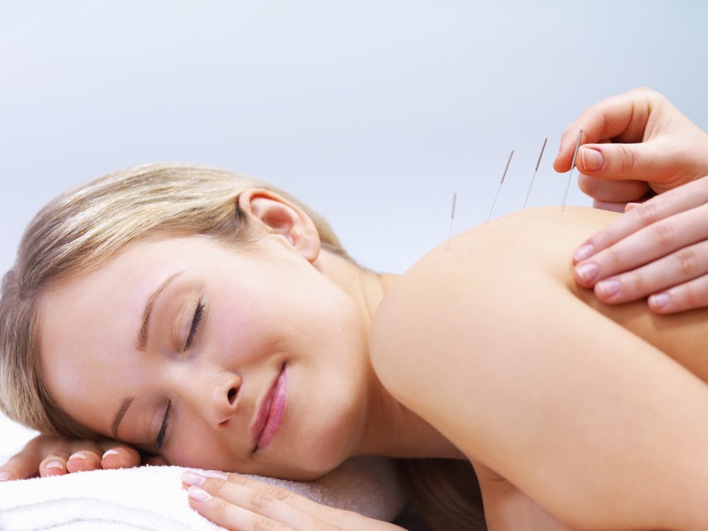 Acupuncture - Patterson Allied Health | health | Thompson Rd, Patterson Lakes VIC 3197, Australia | 0397761600 OR +61 3 9776 1600