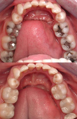 Dental First | dentist | 58 Darcy Rd, Wentworthville NSW 2145, Australia | 0298964190 OR +61 2 9896 4190
