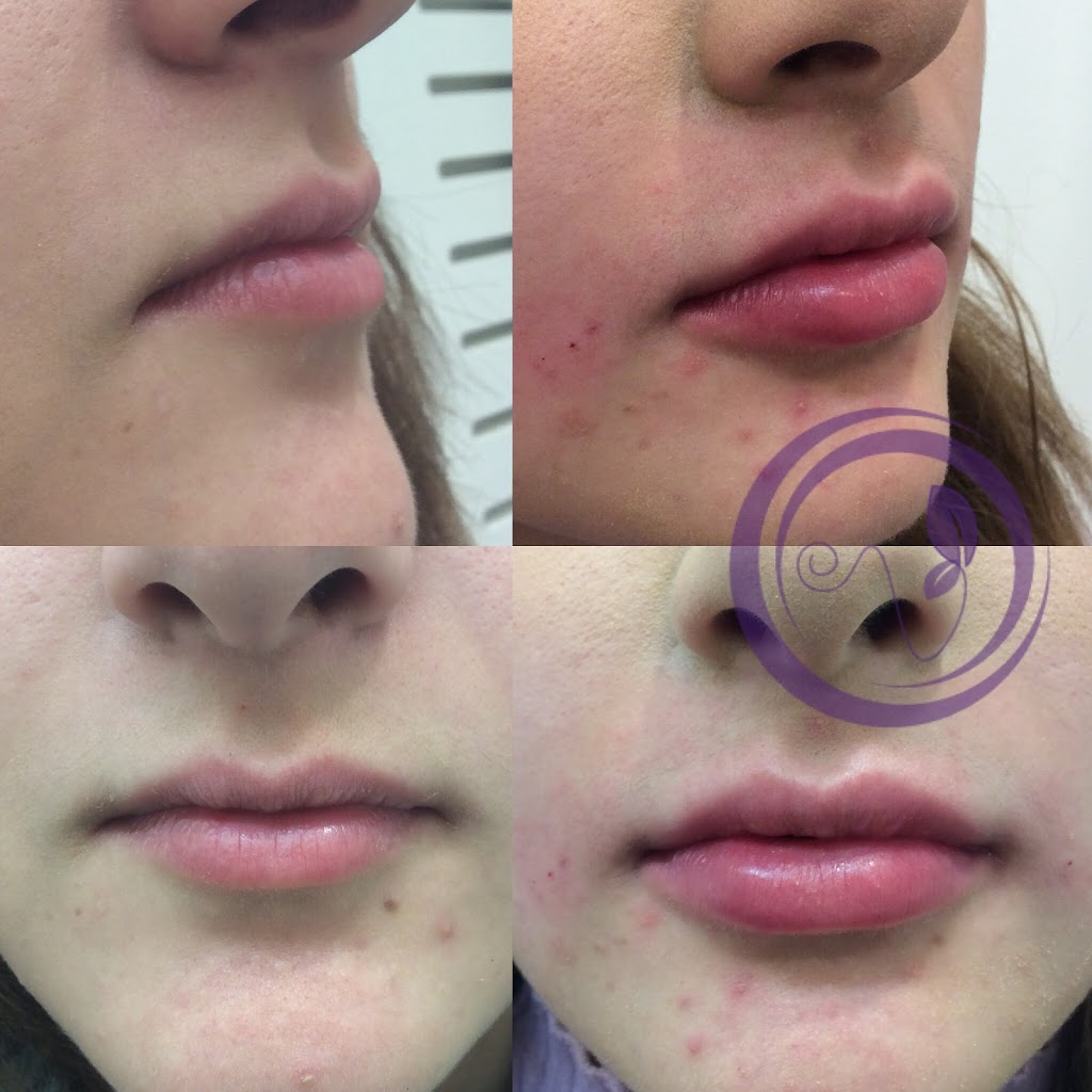 COSMETIC INJECTABLES VICTORIA | health | 11 Foot St, Frankston VIC 3199, Australia | 0450927511 OR +61 450 927 511