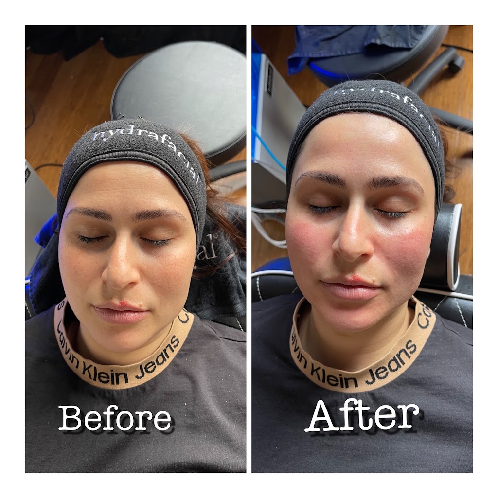 Marbia beauty laser and dermal | 46 Shackel Ave, Kingsgrove NSW 2208, Australia | Phone: 0499 974 952