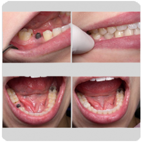 The Dentist In Mosman | dentist | 1/507 Military Rd, Mosman NSW 2088, Australia | 0299696733 OR +61 2 9969 6733