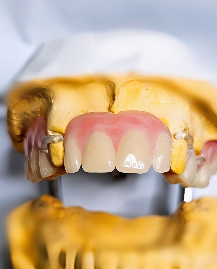 Hill End Dental Laboratory | 8 Majors Ave, Colebee NSW 2761, Australia | Phone: 0410 112 083