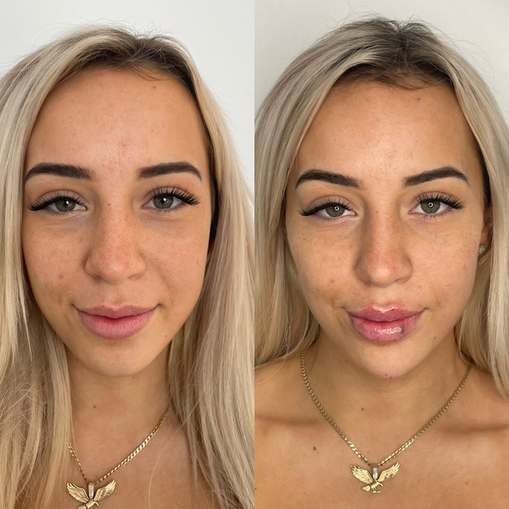 Phoenix Aesthetics Clinic | 30 Elizabeth Bay Dr, Lake Munmorah NSW 2259, Australia | Phone: 0448 784 066