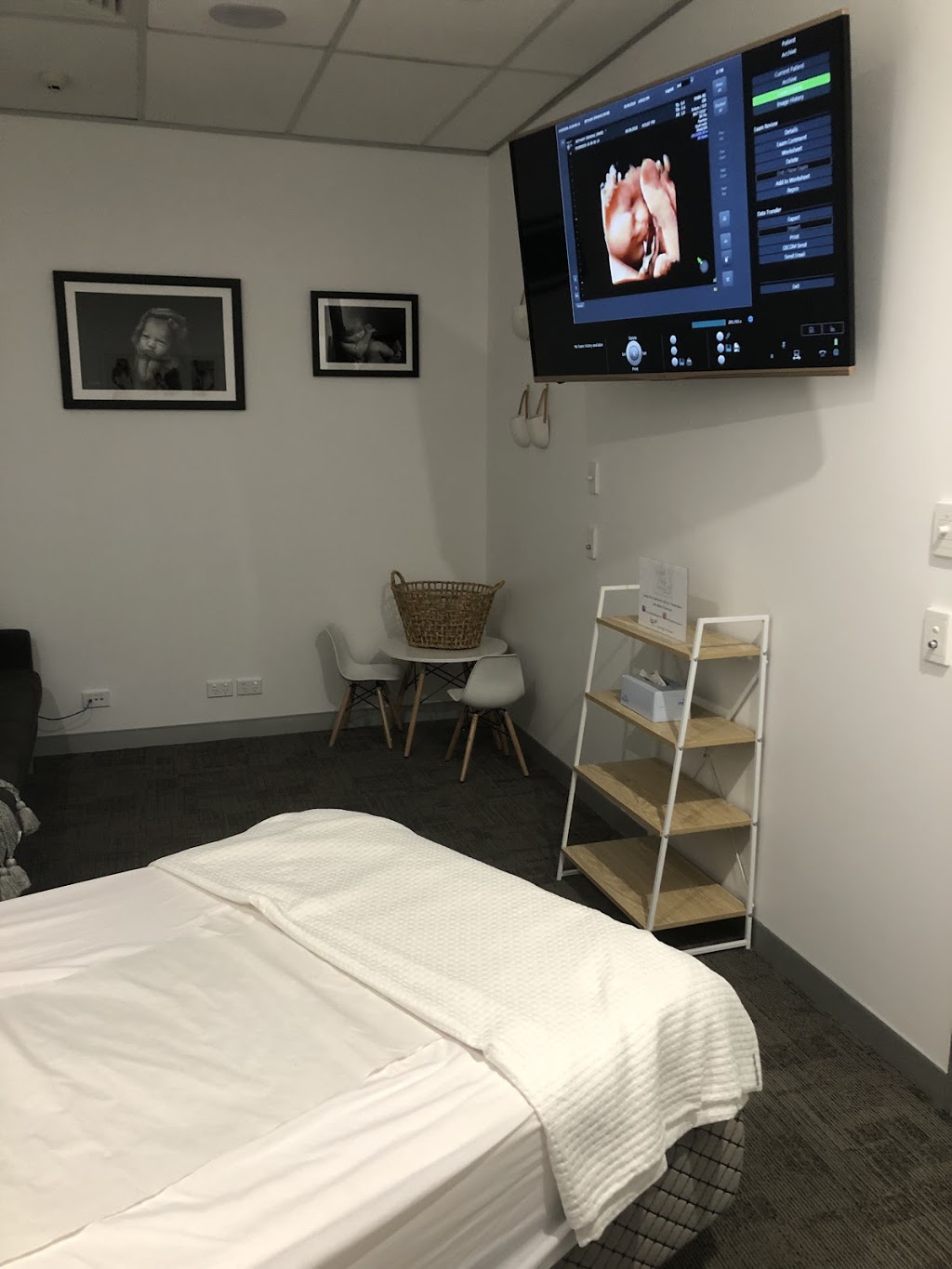 Sneak Peek Ultrasounds | Suite 21 Nucleus Medical Suites, 23 Elsa Wilson Dr, Buderim QLD 4556, Australia | Phone: (07) 5406 0689