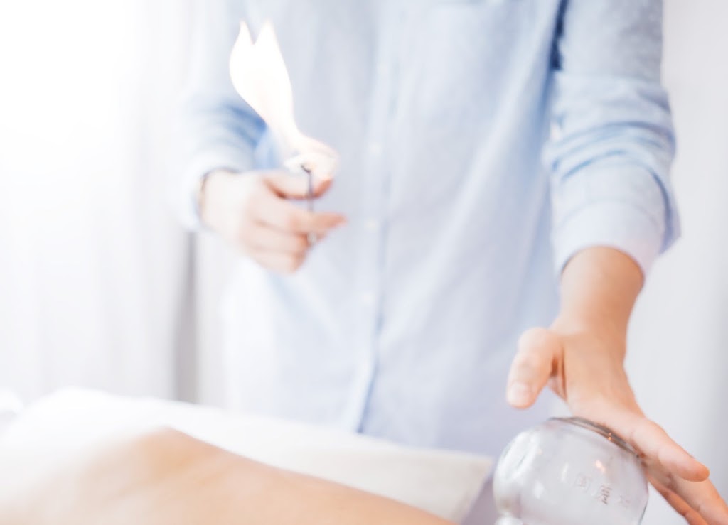 Vyne Health Acupuncture Gold Coast | Suite 9/2098 Gold Coast Hwy, Miami QLD 4220, Australia | Phone: (07) 5515 0409