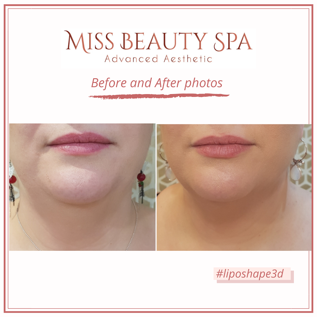 Miss Beauty Spa | health | 2 Taringa Ave, Kellyville NSW 2155, Australia