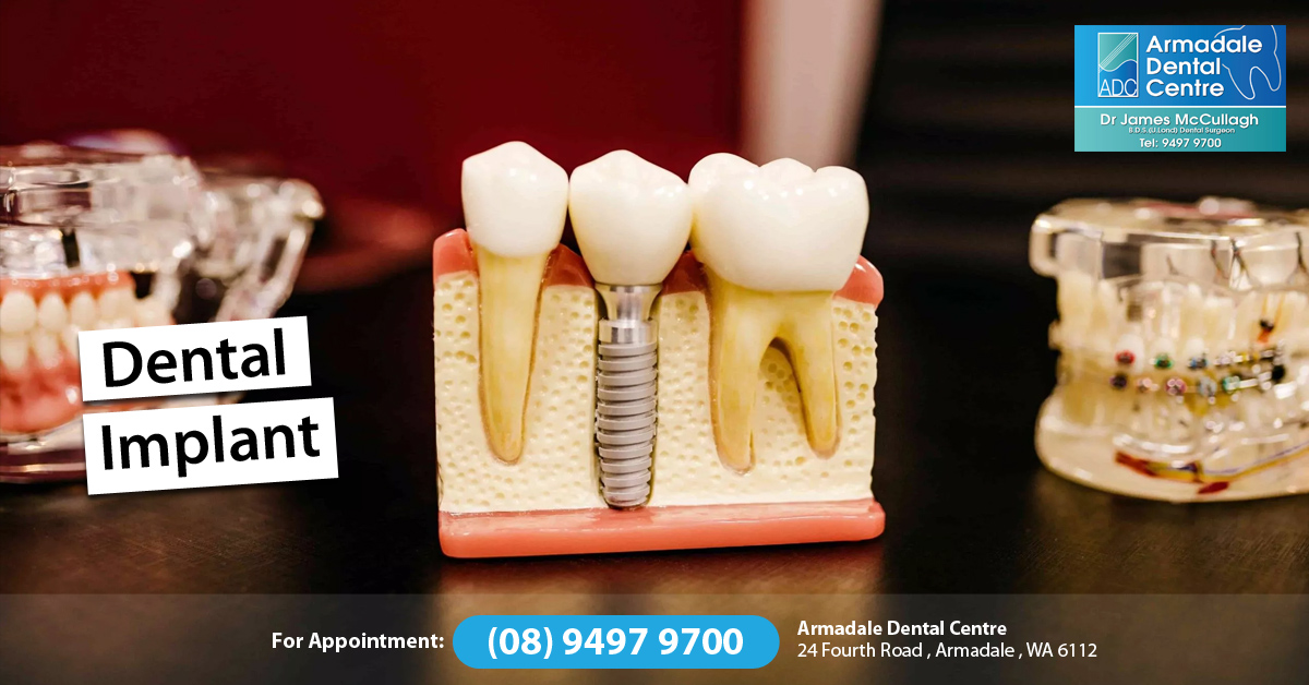 Armadale Dentist - Armadale Dental Centre | dentist | 24 Fourth Road , Armadale ,WA 6112 | 0894979700 OR +61 (08) 9497 9700