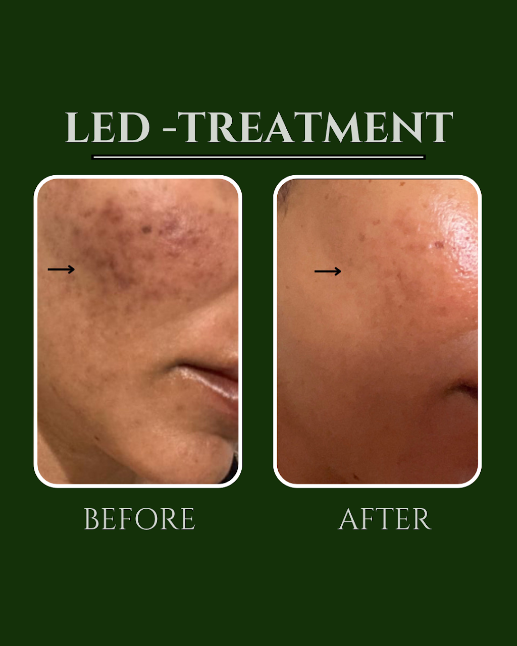 Bodiez By B | 5/141 Maudsland Rd, Oxenford QLD 4210, Australia | Phone: 0447 106 981