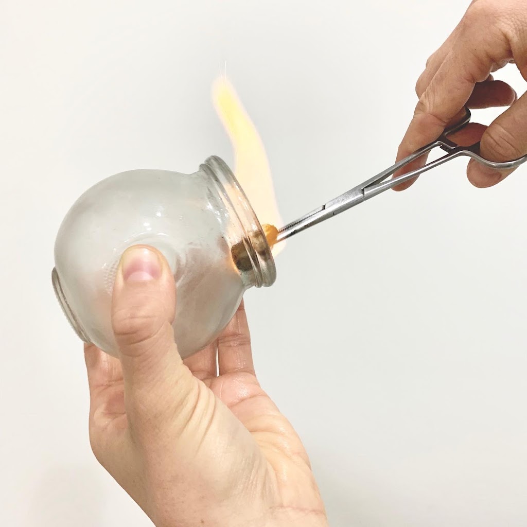 Vyne Health Acupuncture Gold Coast | Suite 9/2098 Gold Coast Hwy, Miami QLD 4220, Australia | Phone: (07) 5515 0409
