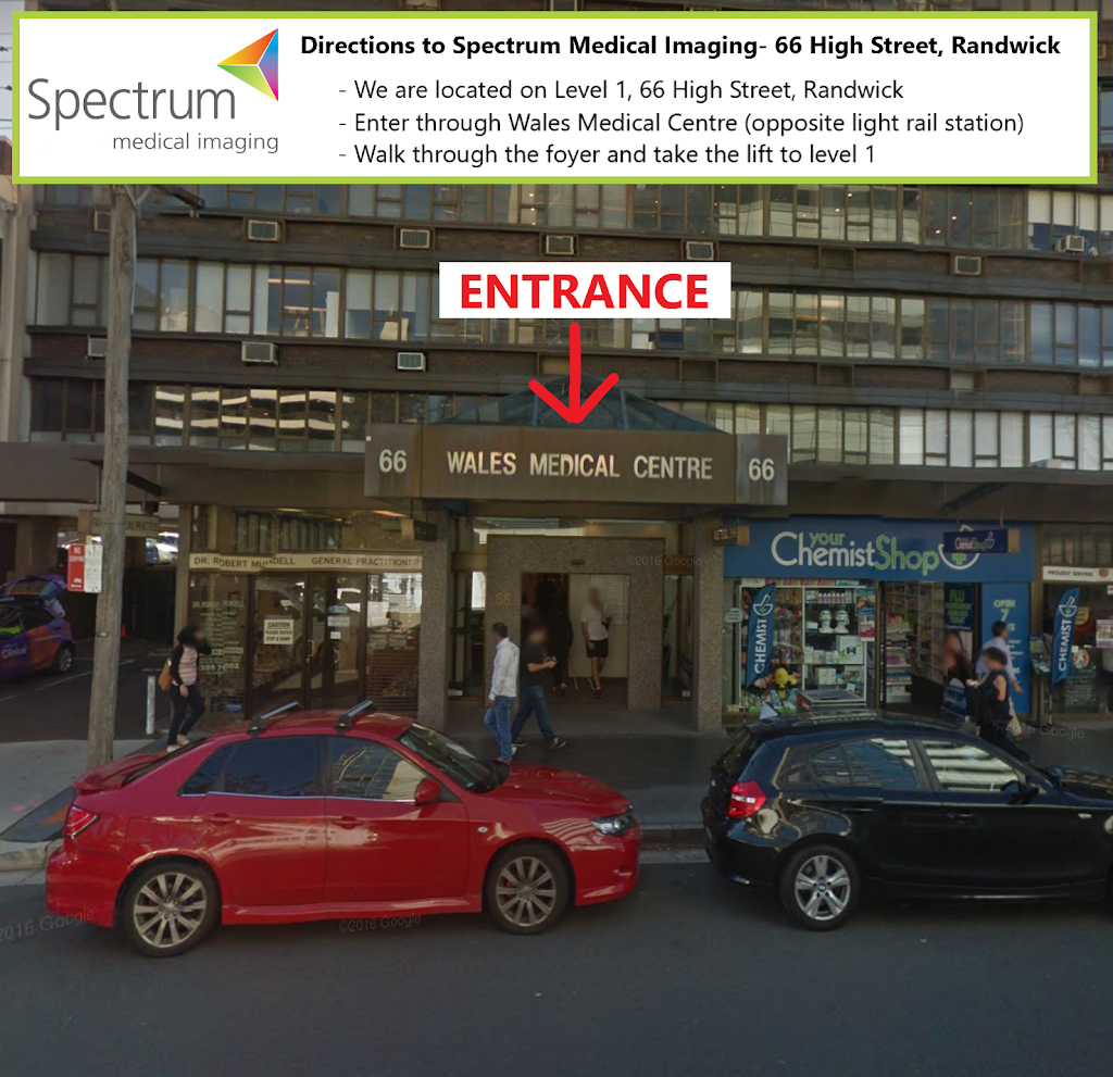 Spectrum Medical Imaging | health | Wales Medical Centre, Level 1/66 High St, Randwick NSW 2031, Australia | 0291978000 OR +61 2 9197 8000