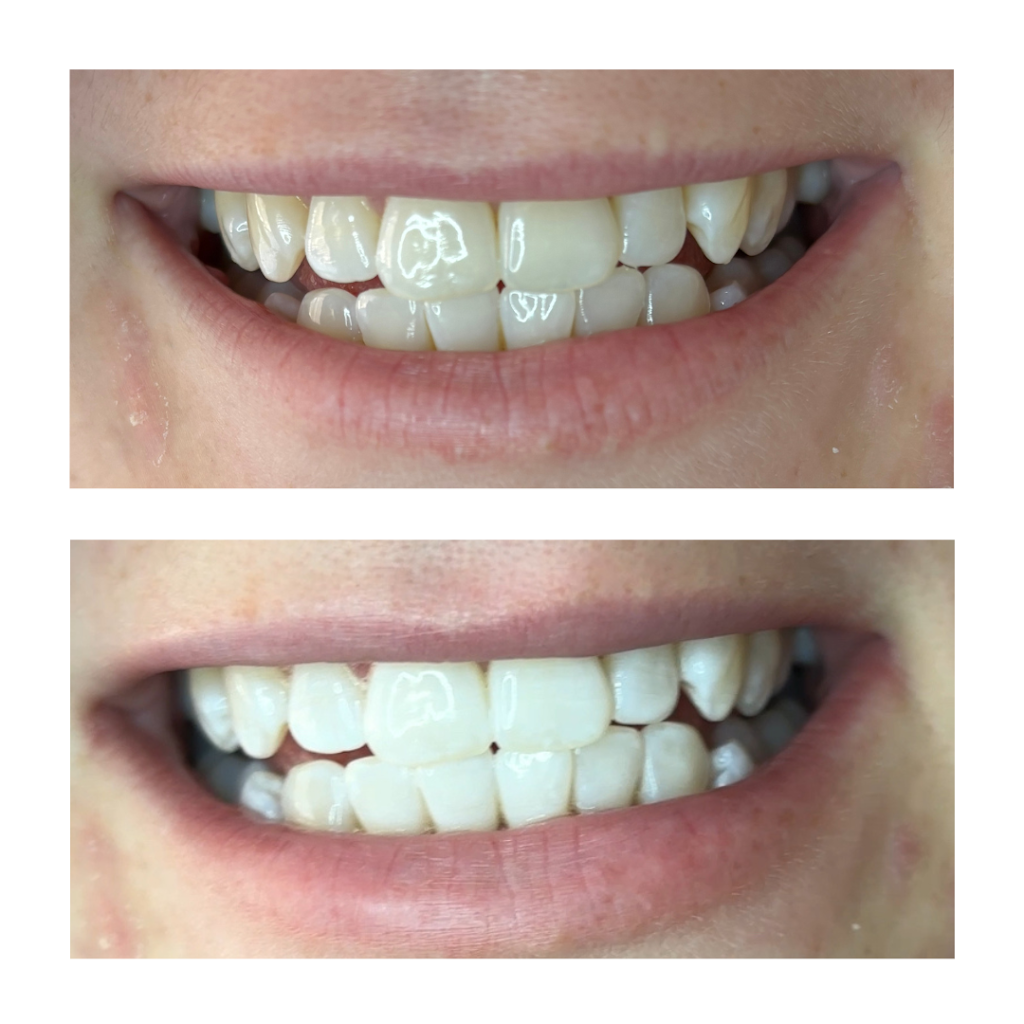 The Whitening Room | MacDougall Rd, Golden Gully VIC 3555, Australia | Phone: 0426 284 861