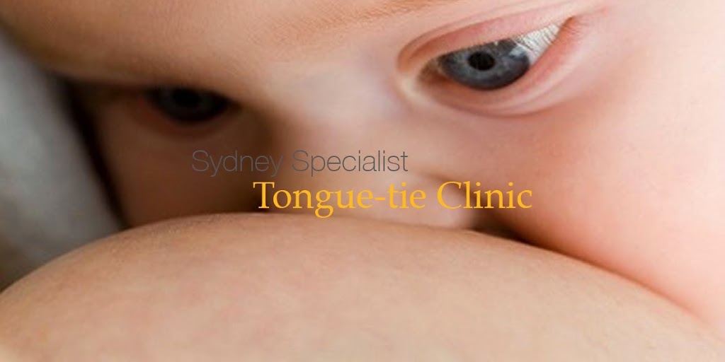 Sydney Specialist Tongue Tie Clinic | dentist | 210/69 Christie St, St Leonards NSW 2065, Australia | 0299065078 OR +61 2 9906 5078