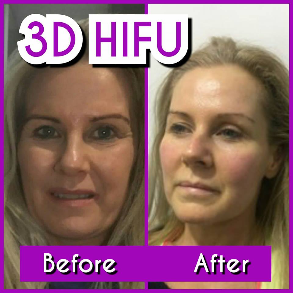 3D Clinic | 4/321 Charman rd, Cheltenham, Melbourne VIC 3192, Australia | Phone: 0406 498 899