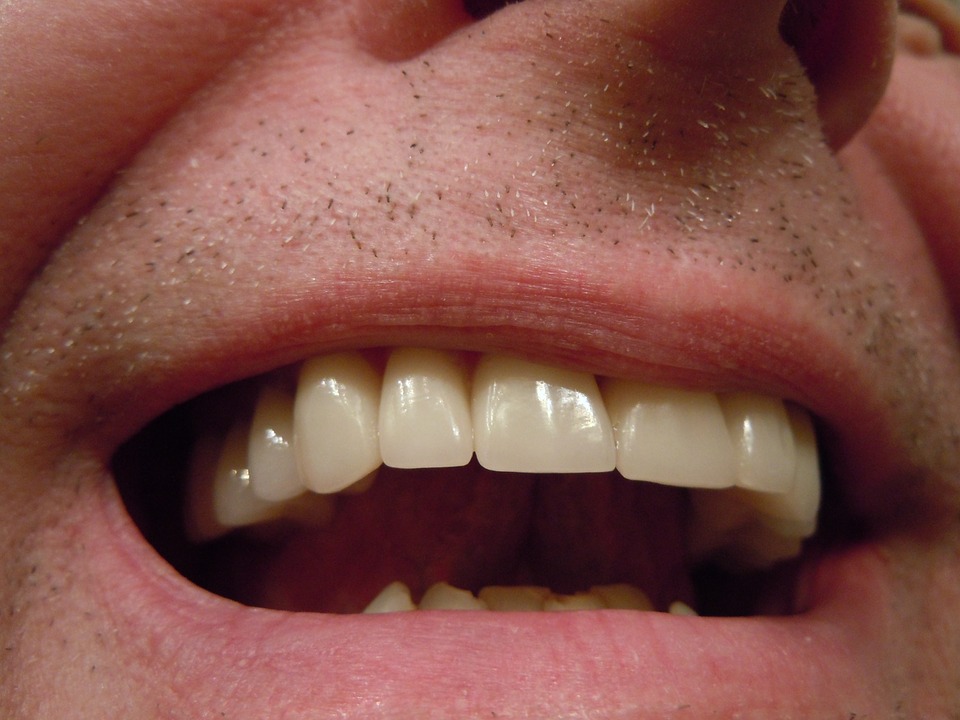 John Willshire Dental (Formally Buderim Marketplace Dental) | dentist | 1/1 Indiana Pl, Kuluin QLD 4558, Australia | 0754452299 OR +61 7 5445 2299