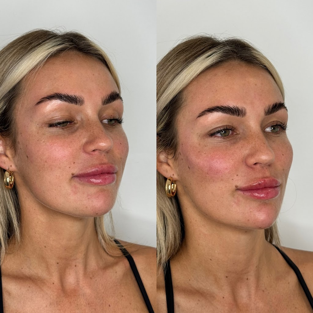 Phoenix Aesthetics Clinic | 30 Elizabeth Bay Dr, Lake Munmorah NSW 2259, Australia | Phone: 0448 784 066