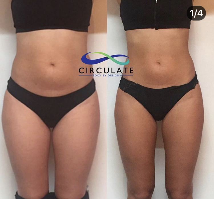 Circulate Clinic | gym | 175 Ferry Rd, Southport QLD 4215, Australia | 0755611188 OR +61 7 5561 1188