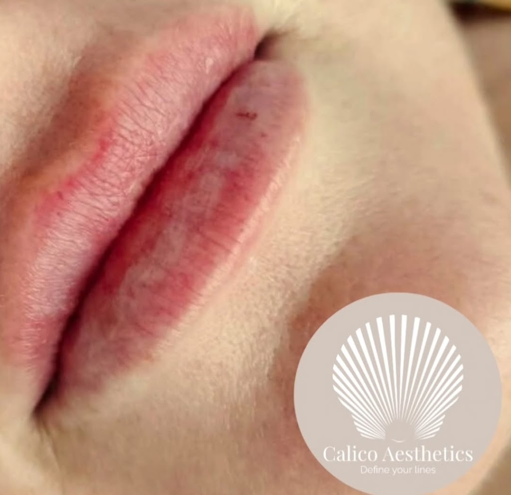 Calico Aesthetics | 28 Cocoanut Point Dr, Zilzie QLD 4710, Australia | Phone: 0422 361 550