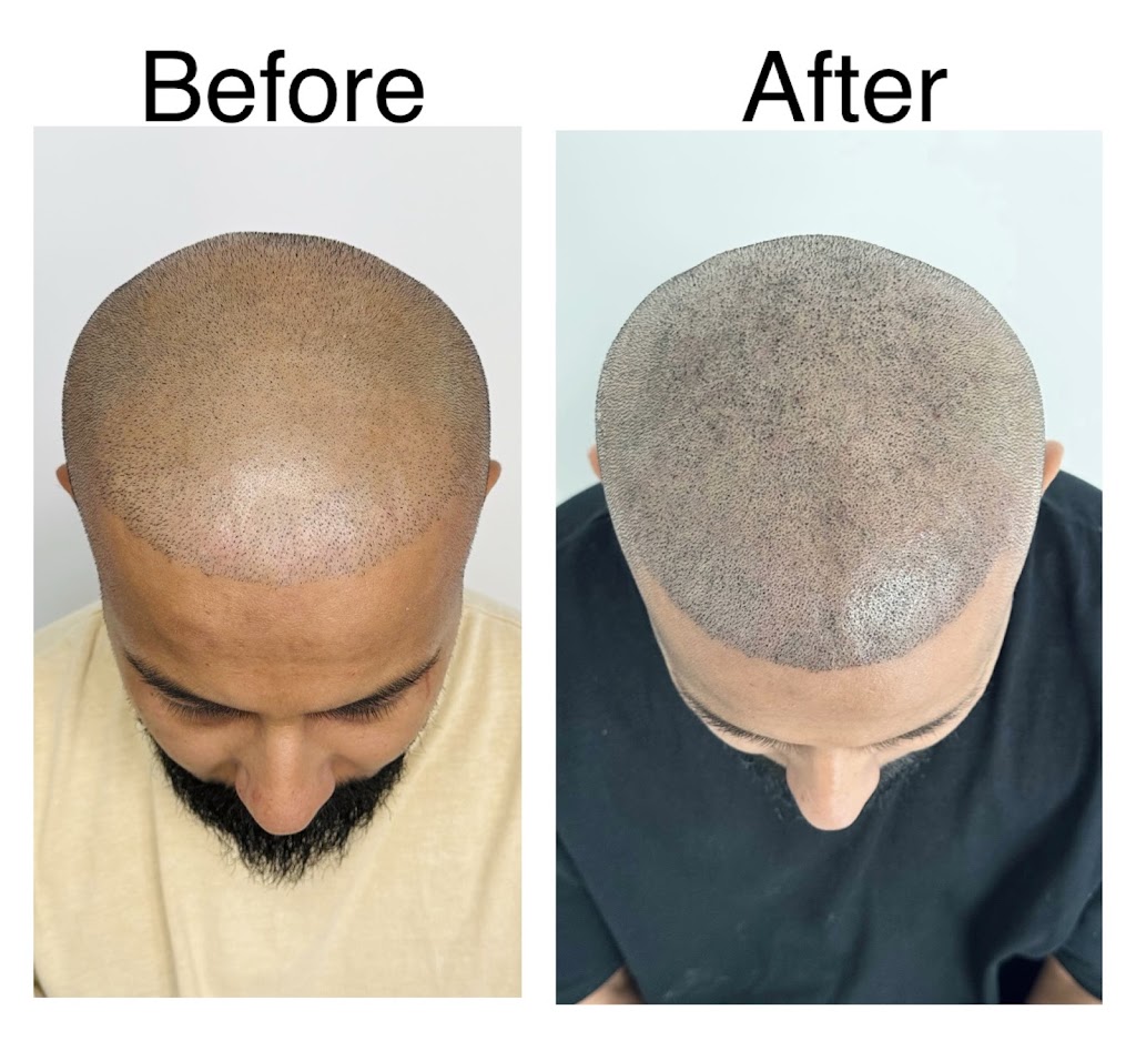 Scalp It SMP Hair Clinic | 11 - 13 Main St, Mount Annan NSW 2567, Australia | Phone: 0405 222 339