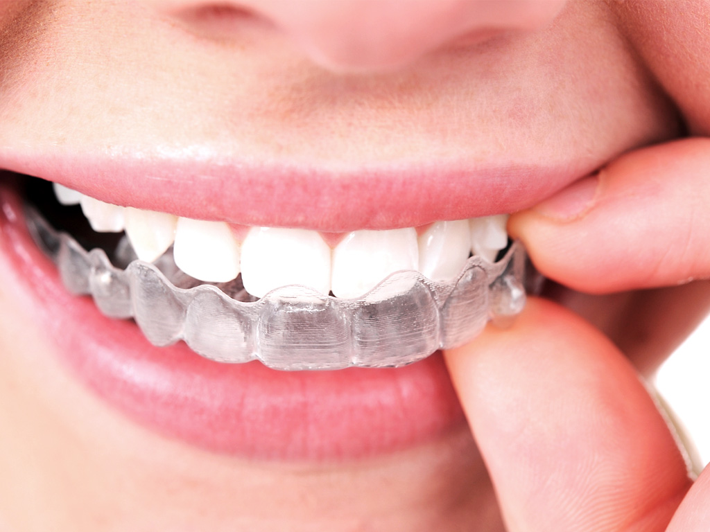 Inline Orthodontics | 12/2 Finucane Rd, Capalaba QLD 4157, Australia | Phone: (07) 3488 0002