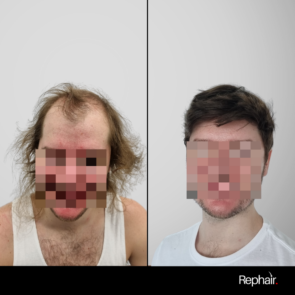 Rephair | 23/58 Riverwalk Ave, Robina QLD 4226, Australia | Phone: 0437 778 852