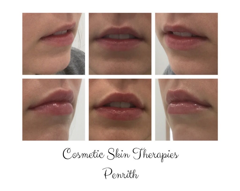 Cosmetic Skin Therapies Penrith - Melissa Stewart RN | store | 138 Smith St, South Penrith NSW 2750, Australia | 0401621174 OR +61 401 621 174