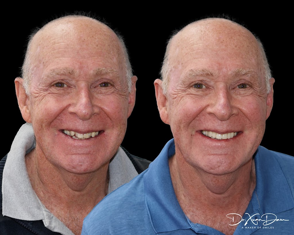 Island Smiles Dental | 3/41 Southsea Terrace, Macleay Island QLD 4184, Australia | Phone: (07) 3409 4454