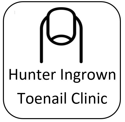 Hunter Ingrown Toenail Clinic | 4/70 Dilkera Ave, Valentine NSW 2280, Australia | Phone: (02) 4989 6499