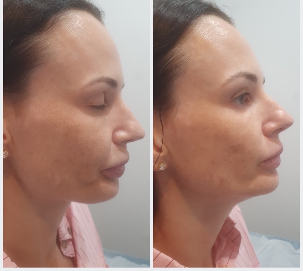 Oh My Skin Maitland | 43 Louth Park Rd, South Maitland NSW 2320, Australia | Phone: 0485 997 894
