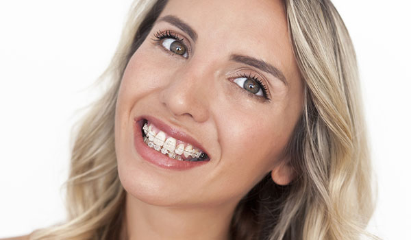 Tony Weir Orthodontics - Invisalign & Braces Orthodontists Brisb | dentist | 667 Oxley Rd, Corinda QLD 4075, Australia | 0732781492 OR +61 7 3278 1492