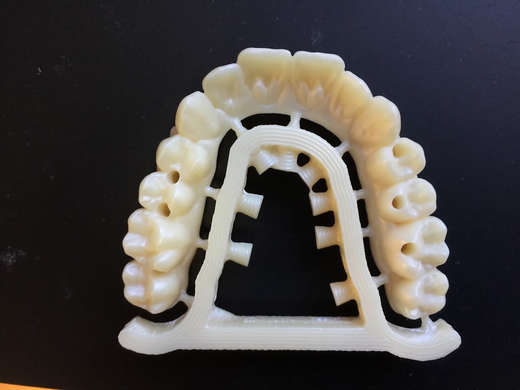 Now Dental | 571 Oxley Ave, Scarborough QLD 4020, Australia | Phone: (07) 3203 4282