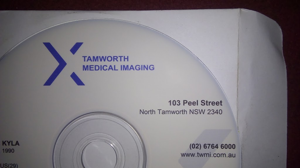 Tamworth Medical Imaging | health | 103 Peel St, North Tamworth NSW 2340, Australia | 0267646000 OR +61 2 6764 6000