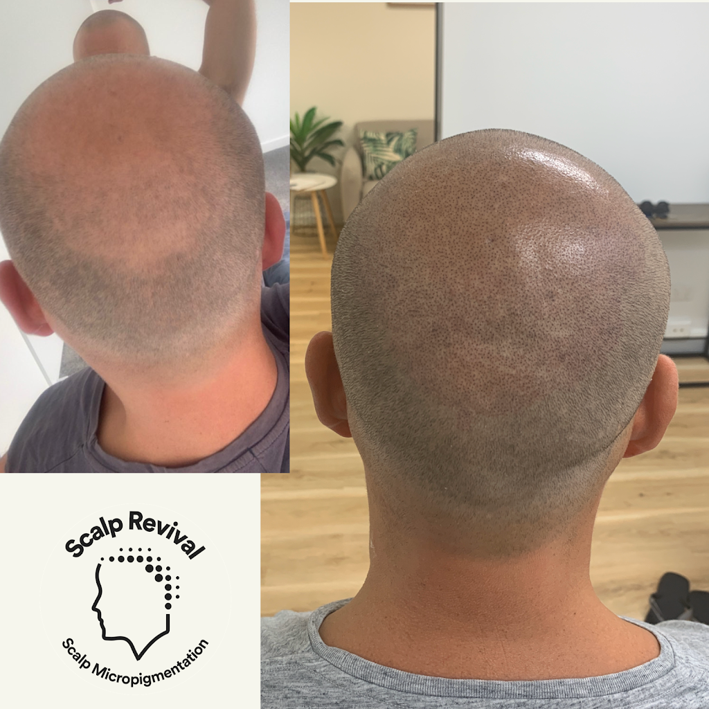 Scalp Revival | 395 Princes Hwy, Woonona NSW 2517, Australia | Phone: 0432 286 697