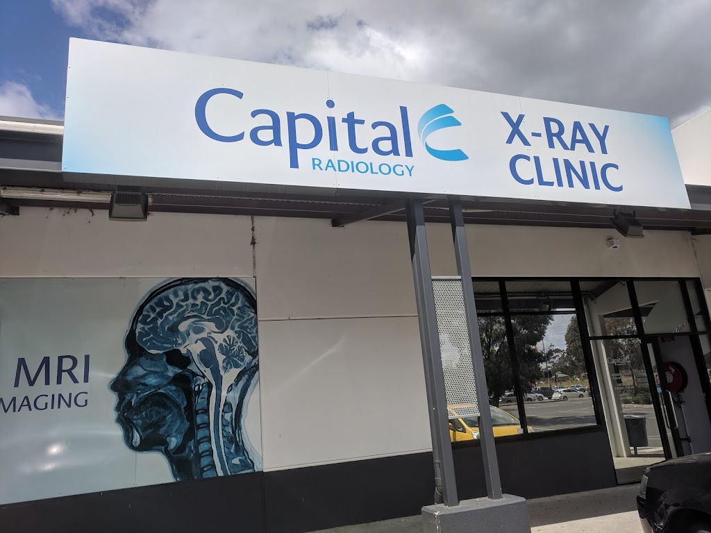 Capital Radiology Epping | doctor | 1/500 High St, Epping VIC 3076, Australia | 0384018401 OR +61 3 8401 8401