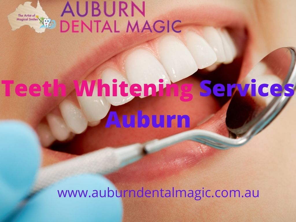 Auburn Dental Magic - Dentist Auburn | dentist | 21 Mary St, Auburn NSW 2144, Australia | 0401905199 OR +61 401 905 199