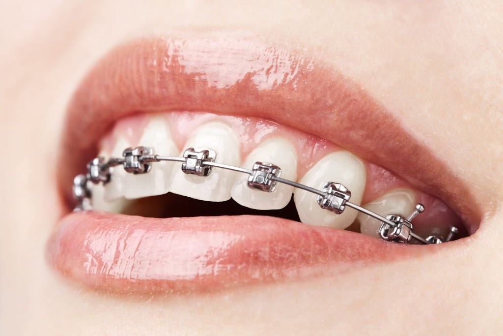 Uplus Dental | dentist | 1H/9 Redmyre Rd, Strathfield NSW 2135, Australia | 0280684080 OR +61 2 8068 4080