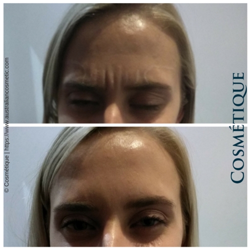 Cosmétique Cosmetic Surgery | beauty salon | Level 1/2/32 Myers St, Geelong VIC 3220, Australia | 0385953055 OR +61 3 8595 3055