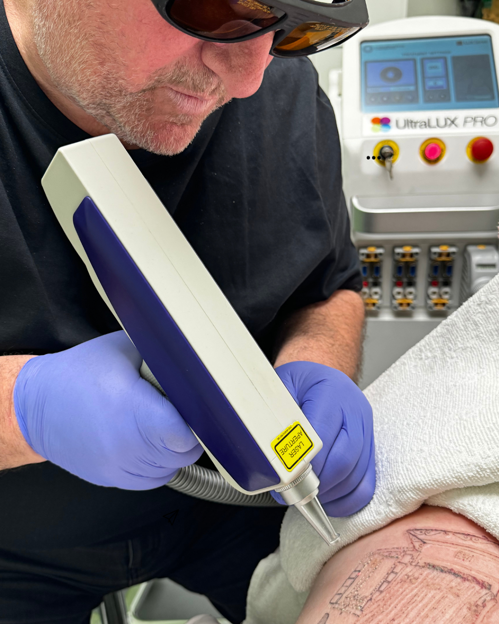 Really Good Tattoo Removal | 47 Clayton St, Sandgate QLD 4017, Australia | Phone: 0413 006 477