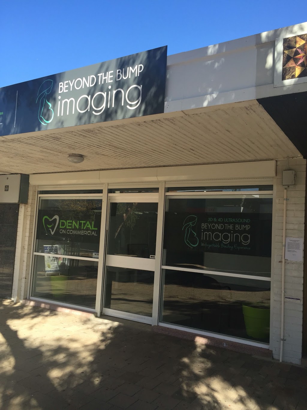 Beyond the Bump Imaging | health | 79 Commercial Rd, Port Augusta SA 5700, Australia | 0487180718 OR +61 487 180 718