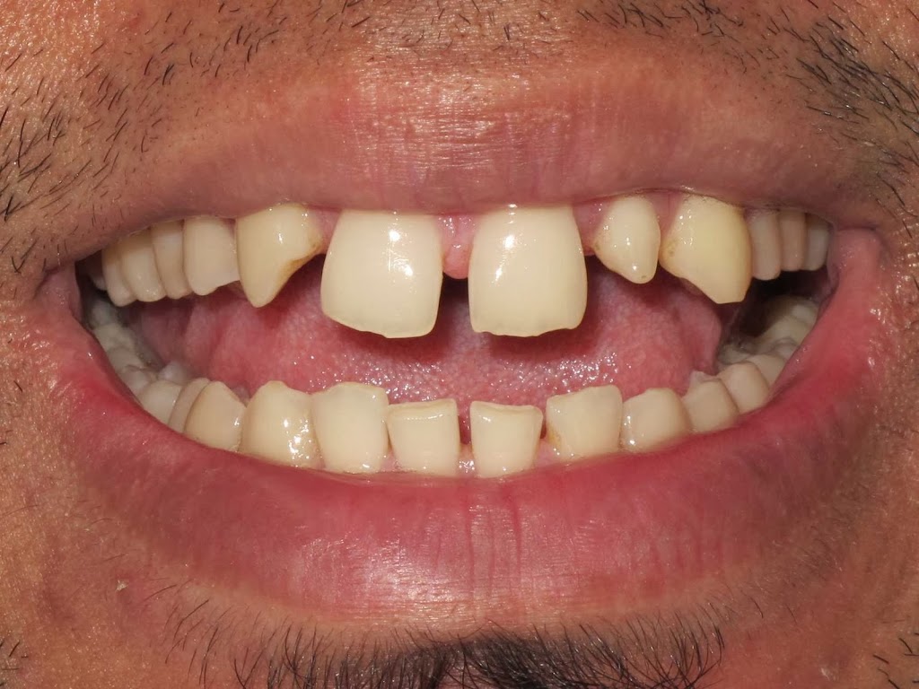 Cosmic Smile Laser Dental | dentist | 212/40 Yeo St, Neutral Bay NSW 2089, Australia | 0299042880 OR +61 2 9904 2880