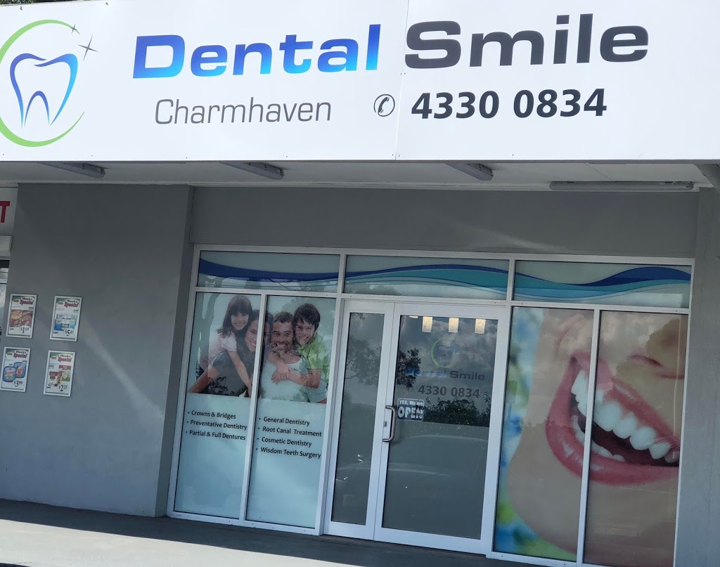 Dental Smile Charmhaven | dentist | shop 7b/195 Pacific Hwy, Charmhaven NSW 2263, Australia | 0243300834 OR +61 2 4330 0834