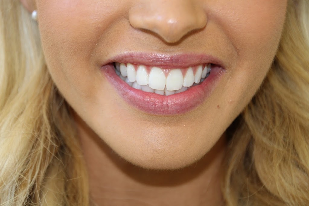 Gorgeous Smiles Dentistry | dentist | 121 Exhibition St, Melbourne VIC 3000, Australia | 0390420483 OR +61 3 9042 0483