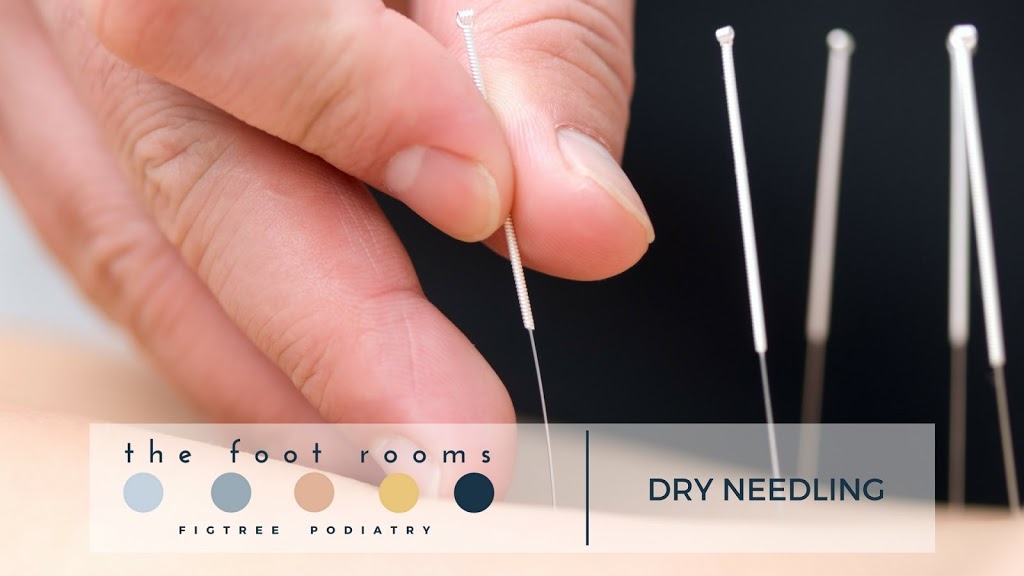 The Foot Rooms Figtree Podiatry | doctor | 177 The Avenue, Figtree NSW 2525, Australia | 0242631268 OR +61 2 4263 1268