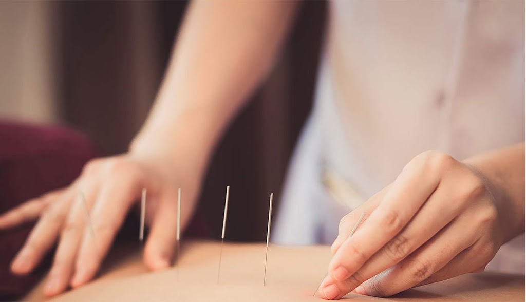 New Leaf Clinic Acupuncture | health | 8 Scott St, East Toowoomba QLD 4350, Australia | 0756606772 OR +61 7 5660 6772