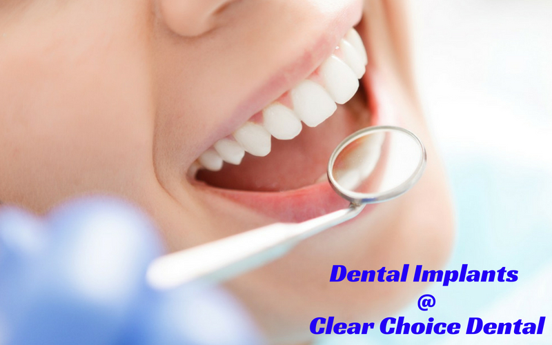 Clear Choice Dental Yokine | dentist | 17/162 Wanneroo Rd, Yokine WA 6060, Australia | 0860016150 OR +61 8 6001 6150